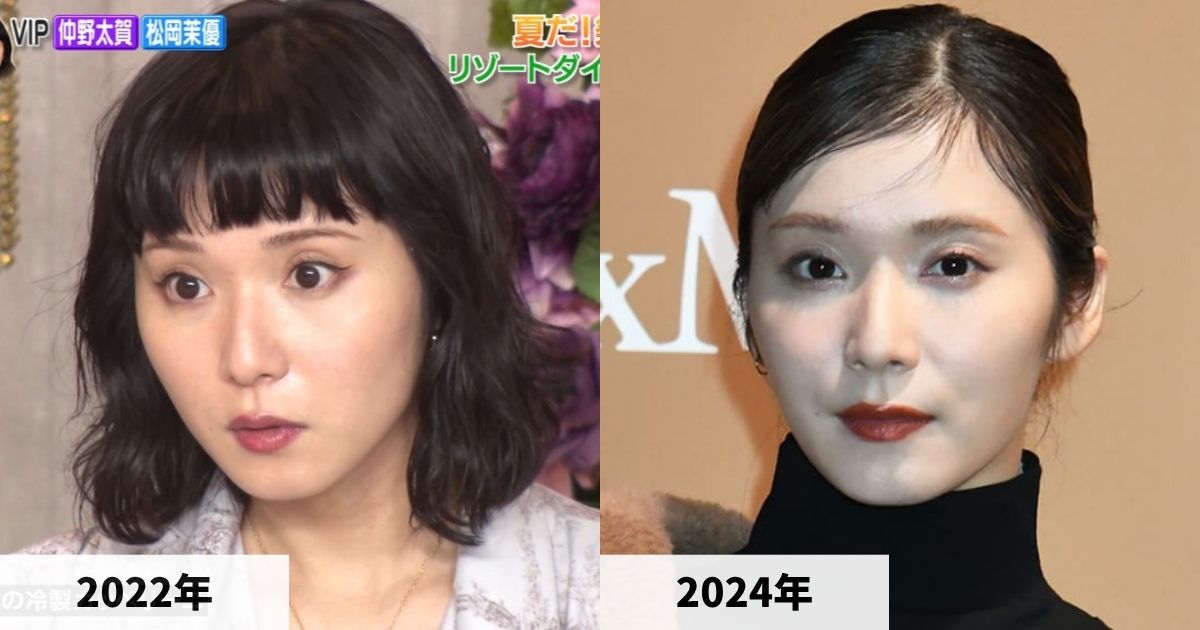 2022年と2024年の松岡茉優さんの顔の比較画像