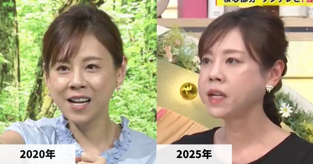 2020年と2025年の高橋真麻さんの顔の比較画像