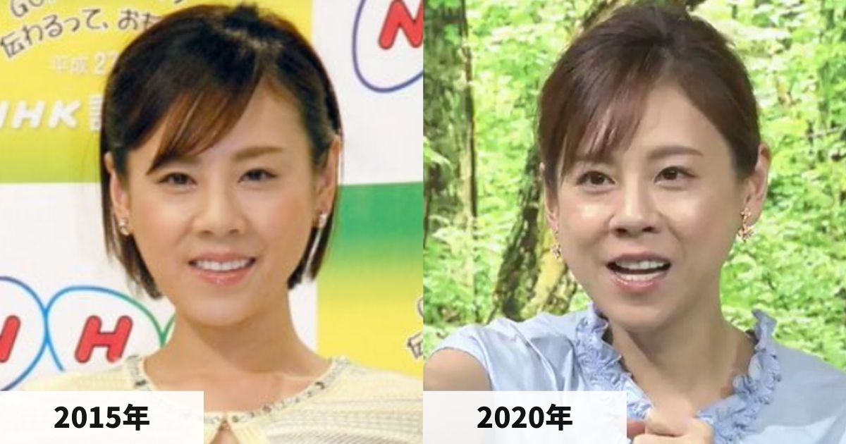 2015年と2020年の高橋真麻さんの顔の比較画像