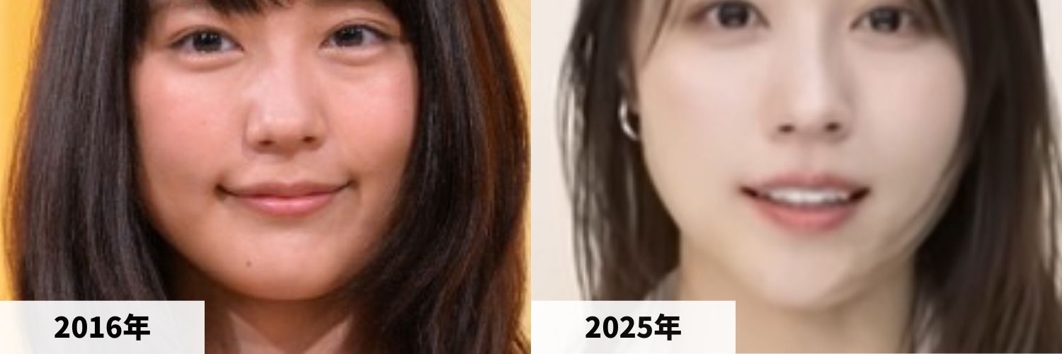 2016年と2025年の有村架純さんのエラの比較画像