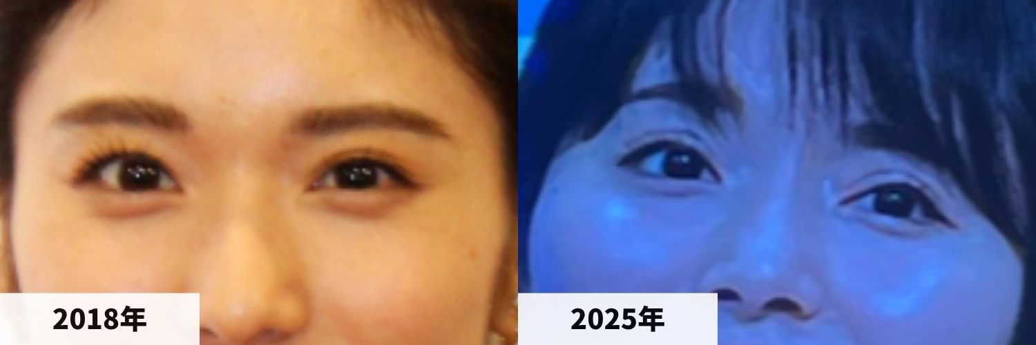 2018年と2025年の松岡茉優さんの目元の比較画像