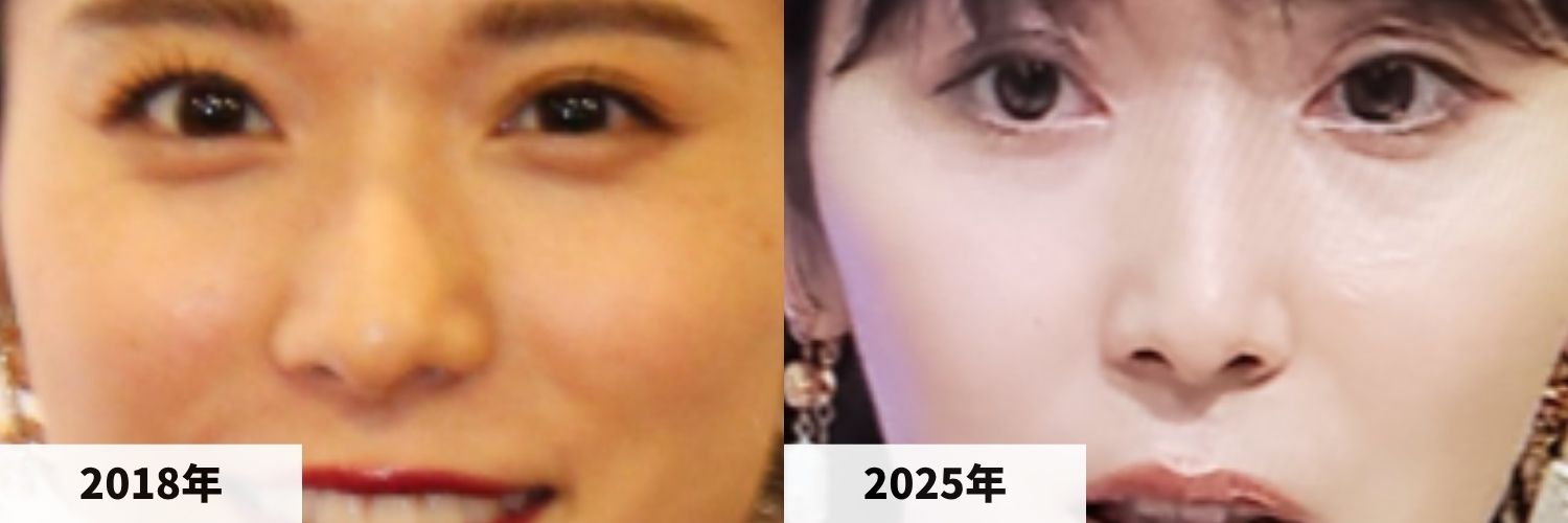 2018年と2025年の松岡茉優さんの鼻の比較画像