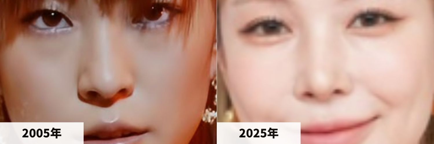 2005年と2025年のBoAの鼻の比較画像