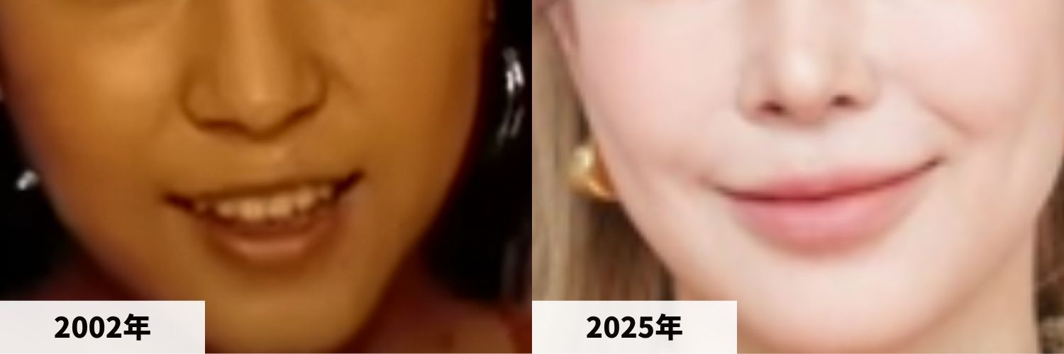 2002年と2025年のBoAの唇の比較画像