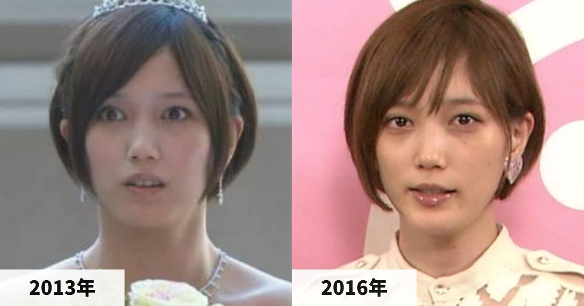 2013年と2016年の本田翼さんの顔の比較画像