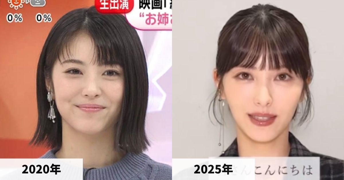 2020年と2025年の浜辺美波さんの顔の比較画像