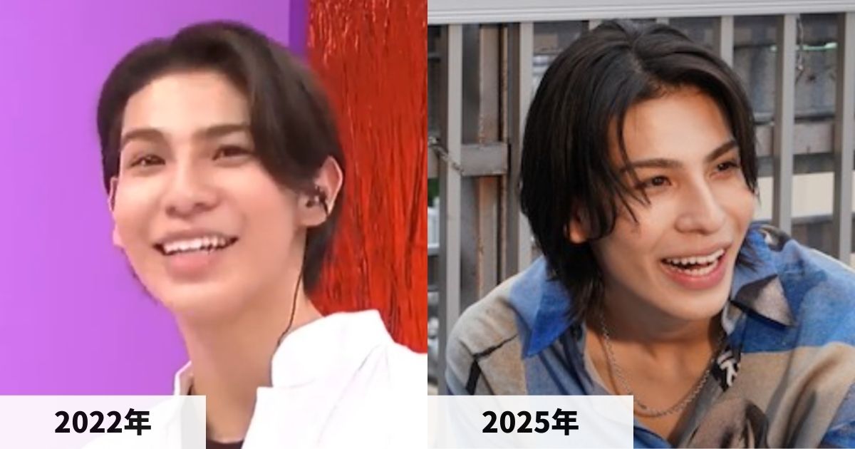 2022年と2025年のラウールさんの顔の比較画像