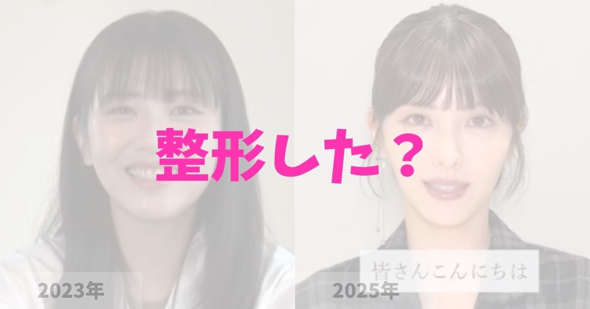 浜辺美波の顔が変わったのは整形したから？の記事