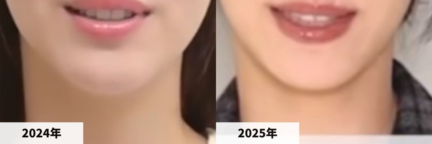 2024年と2025年の浜辺美波さんのアゴの比較画像