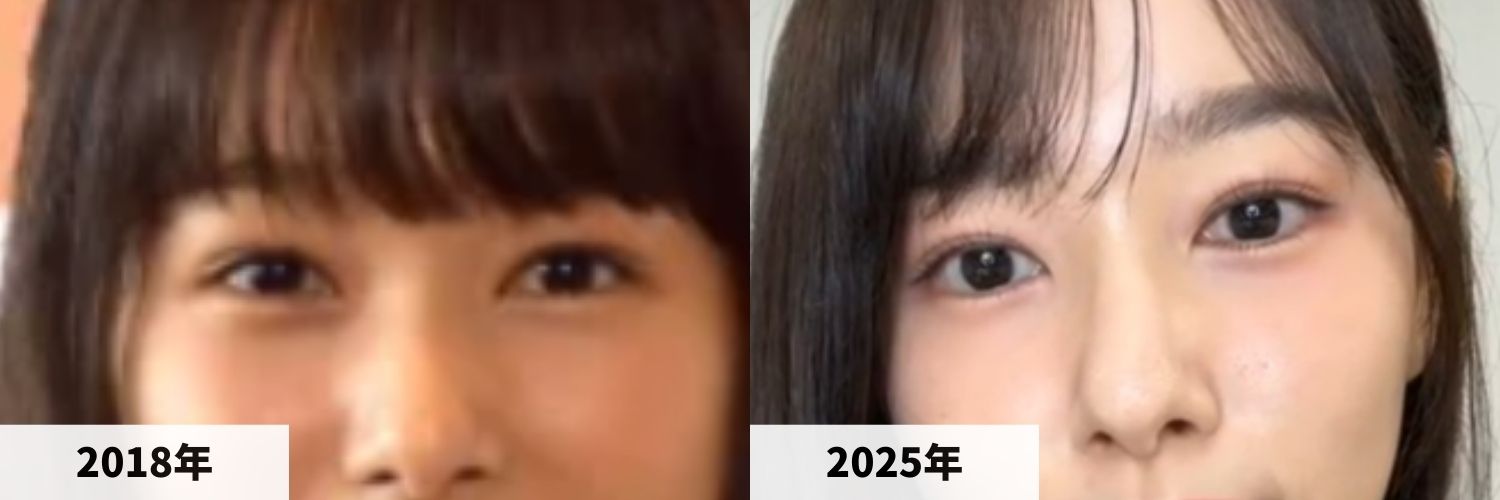 2018年と2025年の桜井日奈子さんの目元の比較画像