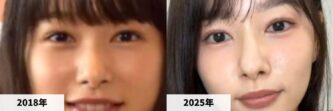 桜井日奈子の顔が変わったと話題！目頭や鼻の整形疑惑か？それともメイク？最近の変化を徹底検証！(2025) | りょくブロラジオ日和