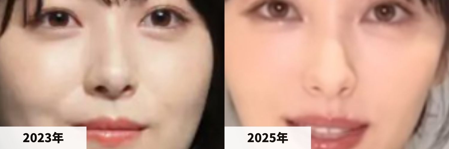 2023年と2025年の浜辺美波さんの鼻の比較画像