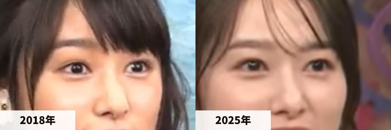 2018年と2025年の桜井日奈子さんの目元の比較画像