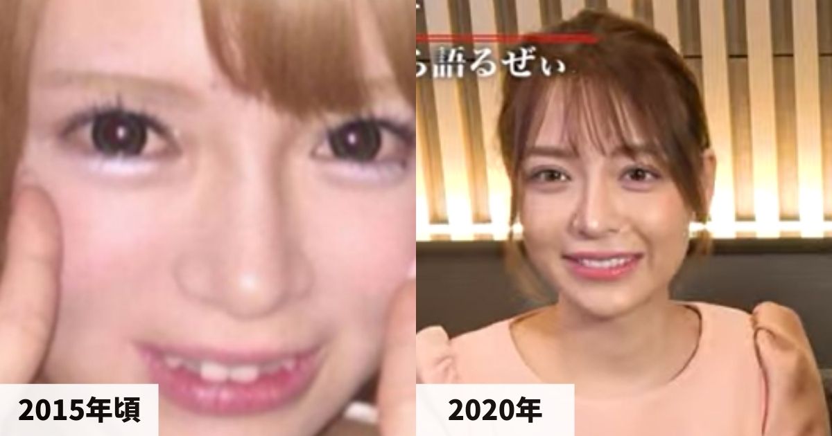 20215年頃と2020年の進撃のノアさんの顔の比較画像