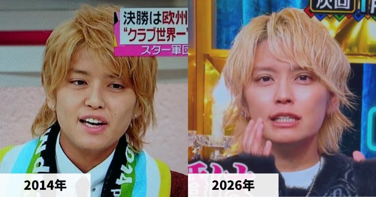 2014年と2026年の手越祐也さんの顔の比較画像