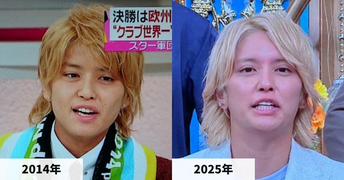 2014年と2025年の手越祐也さんの顔の比較画像
