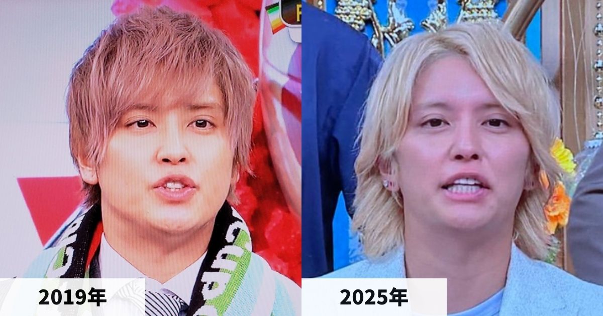 2019年と2025年の手越祐也さんの顔の比較画像
