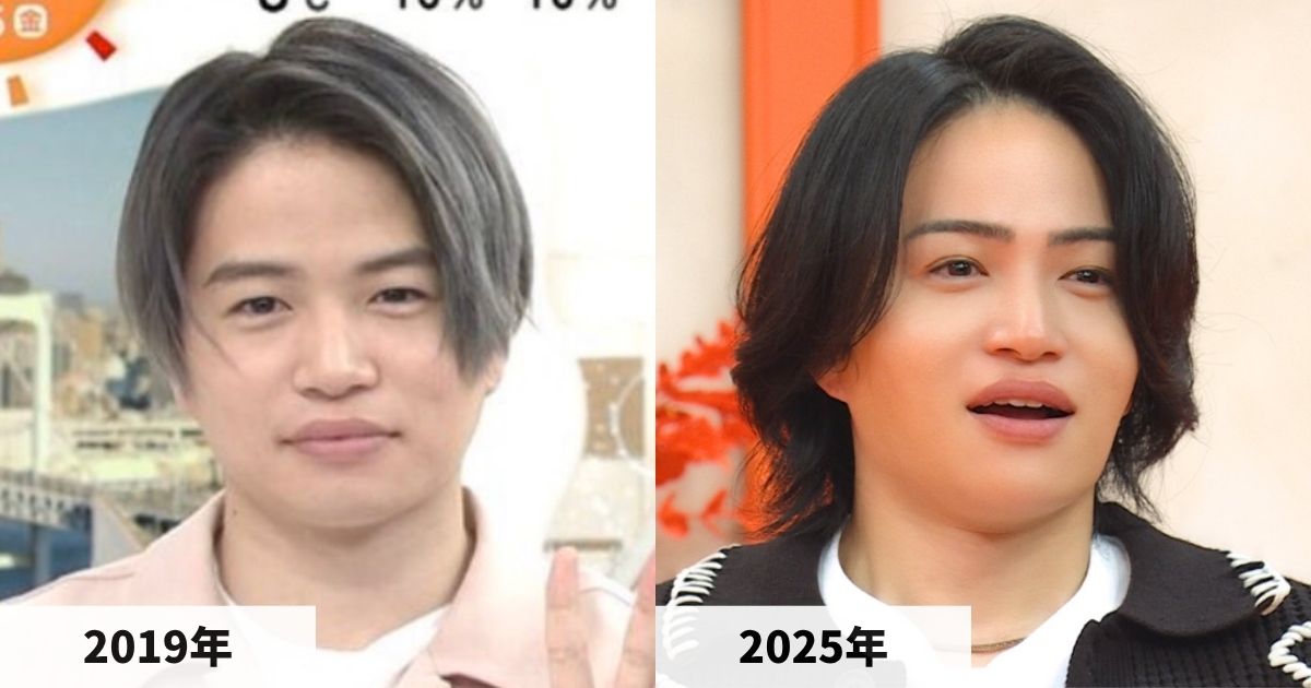2019年と2025年の菊池風磨さんの顔の比較画像