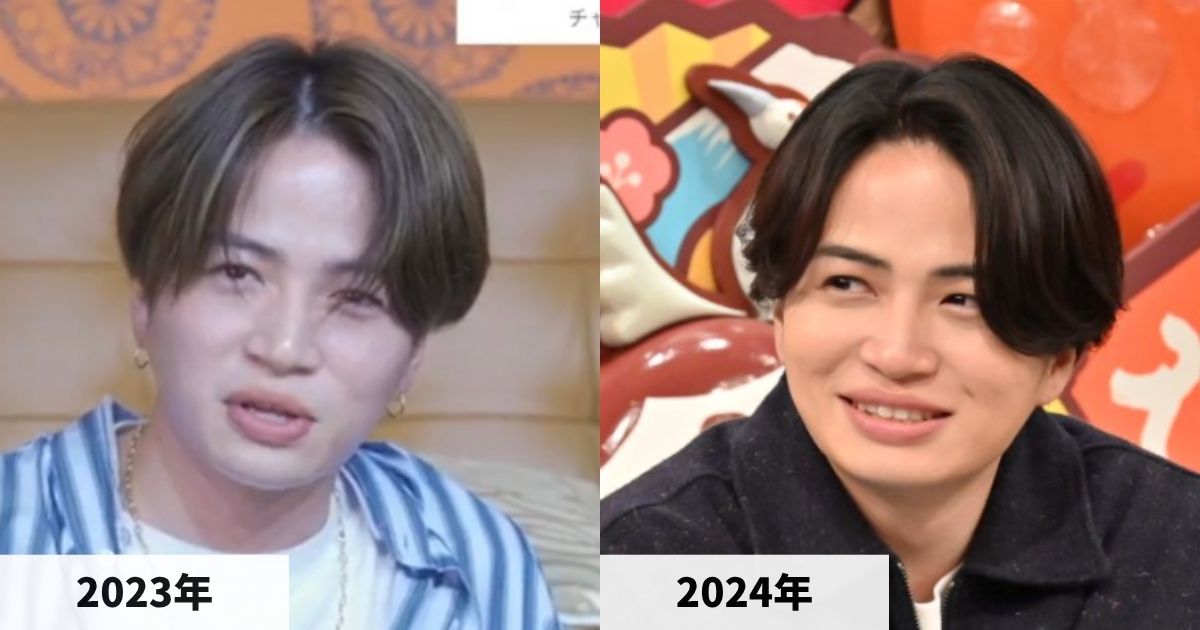 2023年と2024年の菊池風磨さんの顔の比較画像