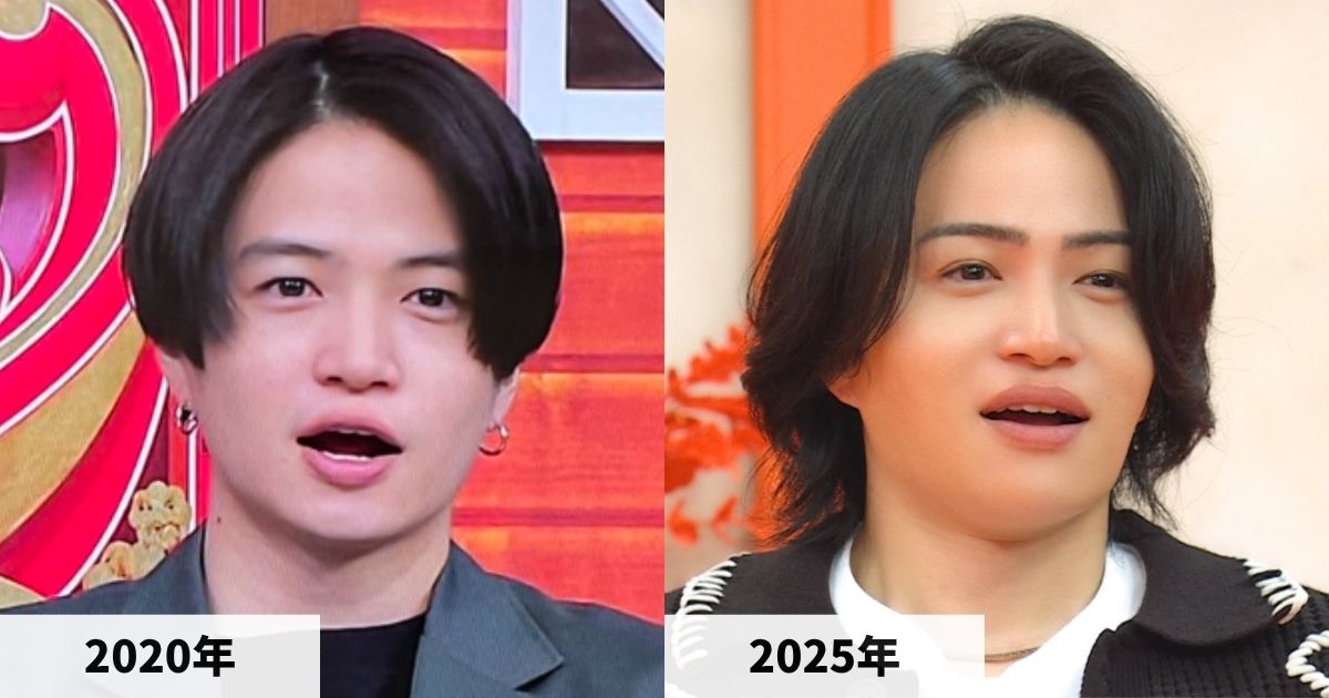 2020年と2025年の菊池風磨さんの顔の比較画像