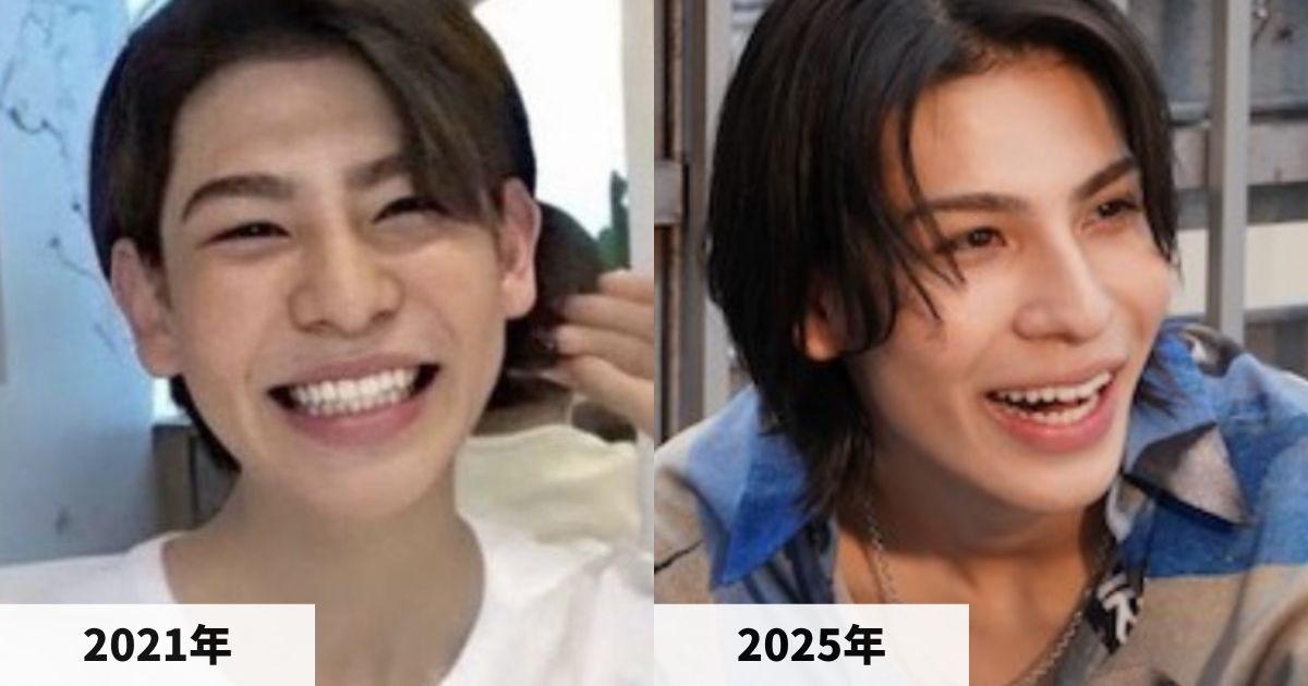 2021年と2025年のラウールさんの顔の比較画像
