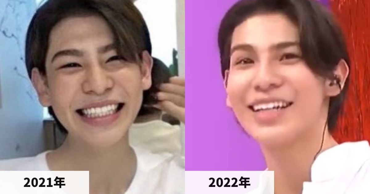 2021年と2022年のラウールさんの顔の比較画像