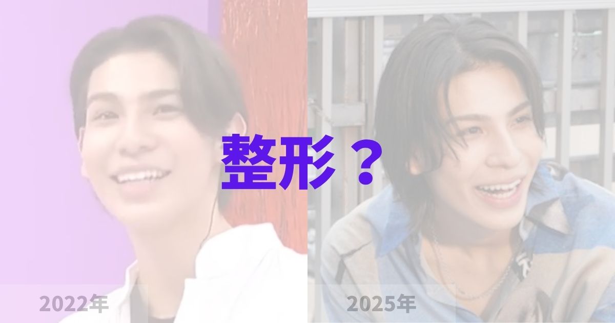 ラウールの顔が変わったのは整形？の記事
