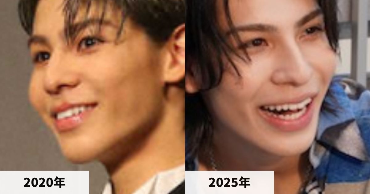 2020年と2025年のラウールさんの唇の比較画像