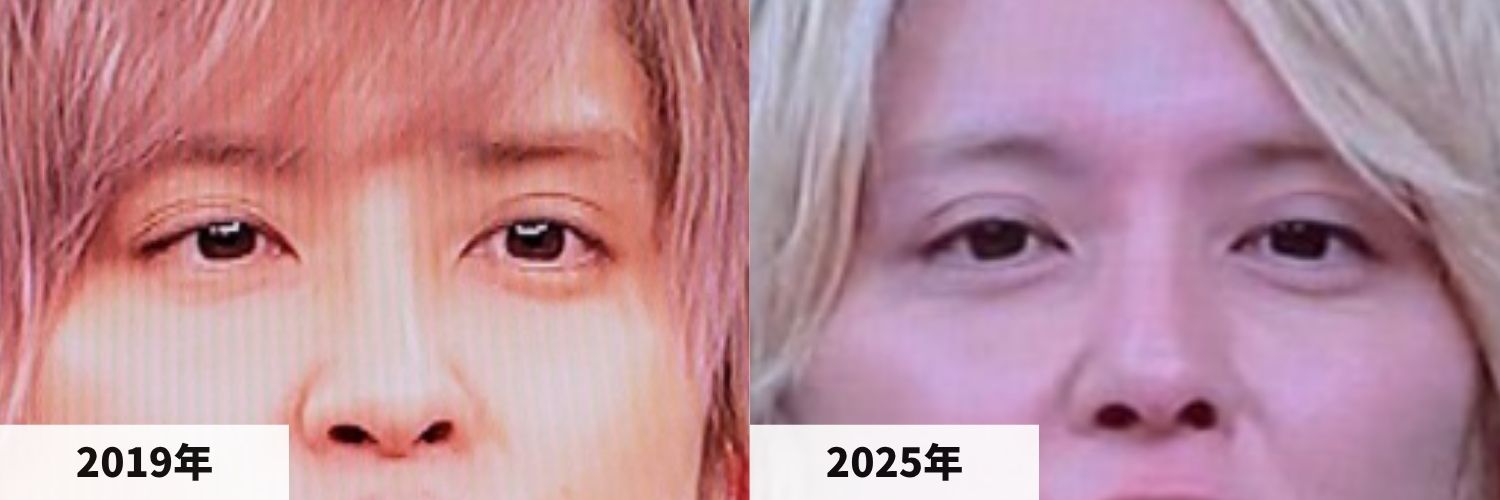 2019年と2025年の手越祐也さんの目元の比較画像