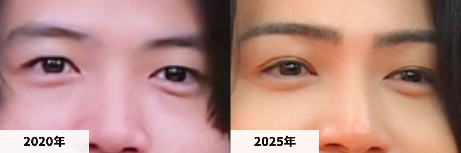 2020年と2025年の菊池風磨さんの目元の比較画像