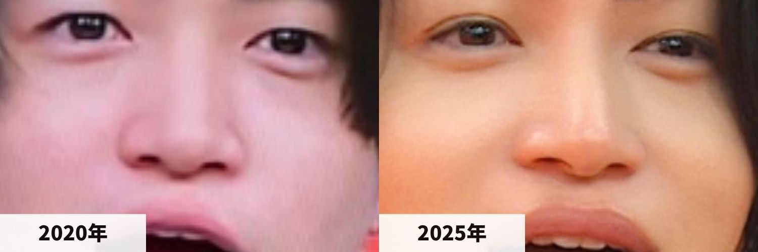 2020年と2025年の菊池風磨さんの鼻の比較画像