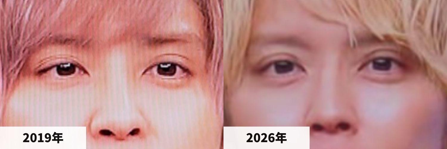 2019年と2026年の手越祐也さんの目元の比較画像