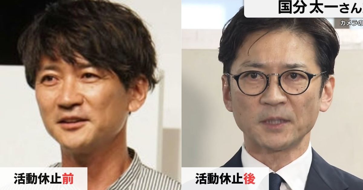 活動休止前後の国分太一さんの顔の比較画像
