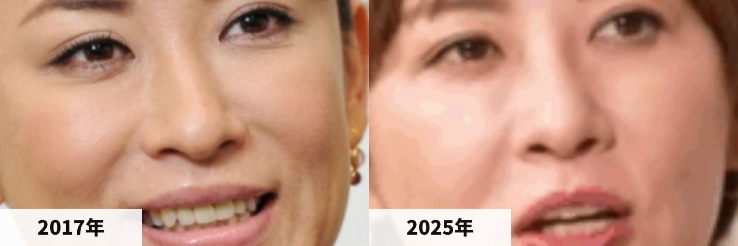 2017年と2025年の鈴木砂羽さんの鼻の比較画像