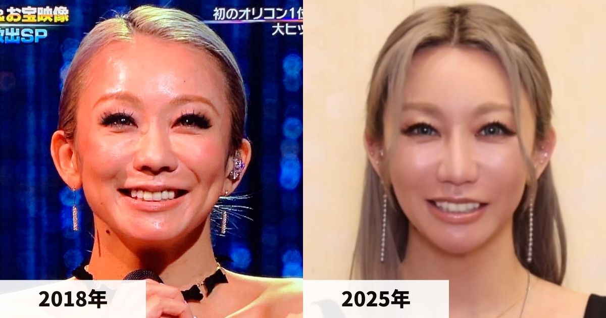2018年と2025年の倖田來未さんの顔の比較画像