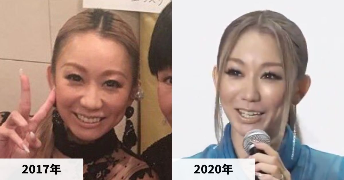 2017年と2020年の倖田來未さんの顔の比較画像