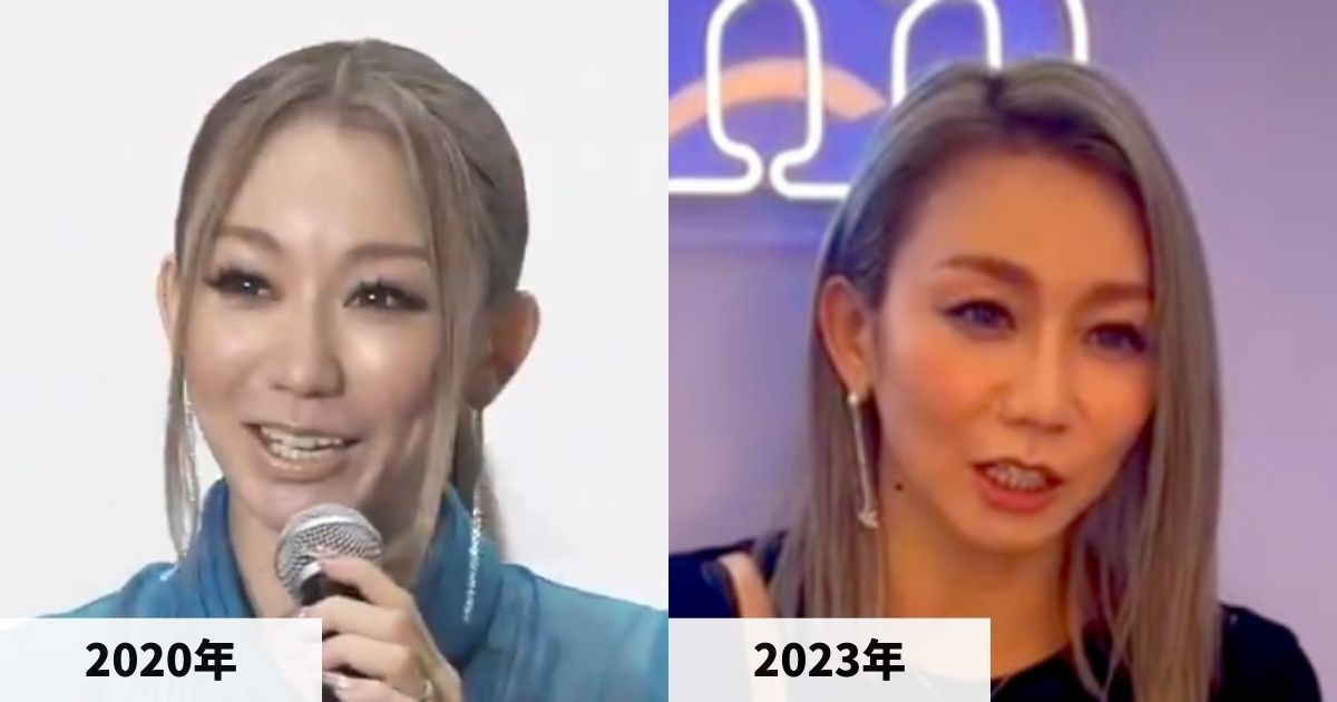 2020年と2023年の倖田來未さんの顔の比較画像
