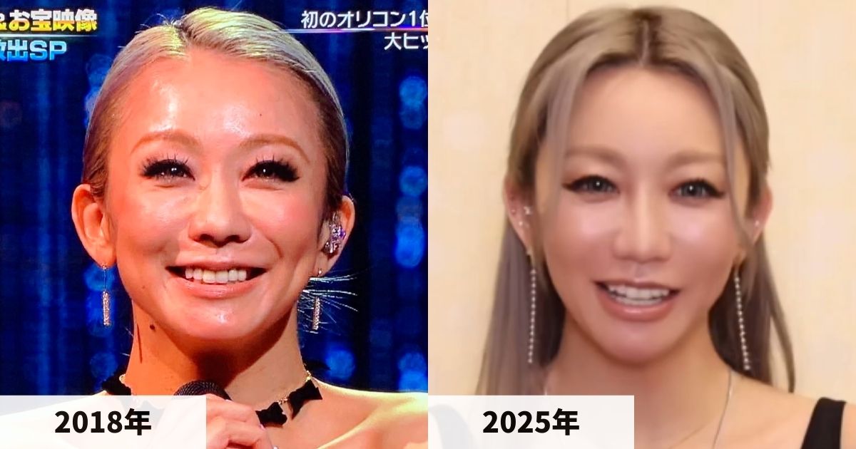 2018年と2025年の倖田來未さんの肌の比較画像