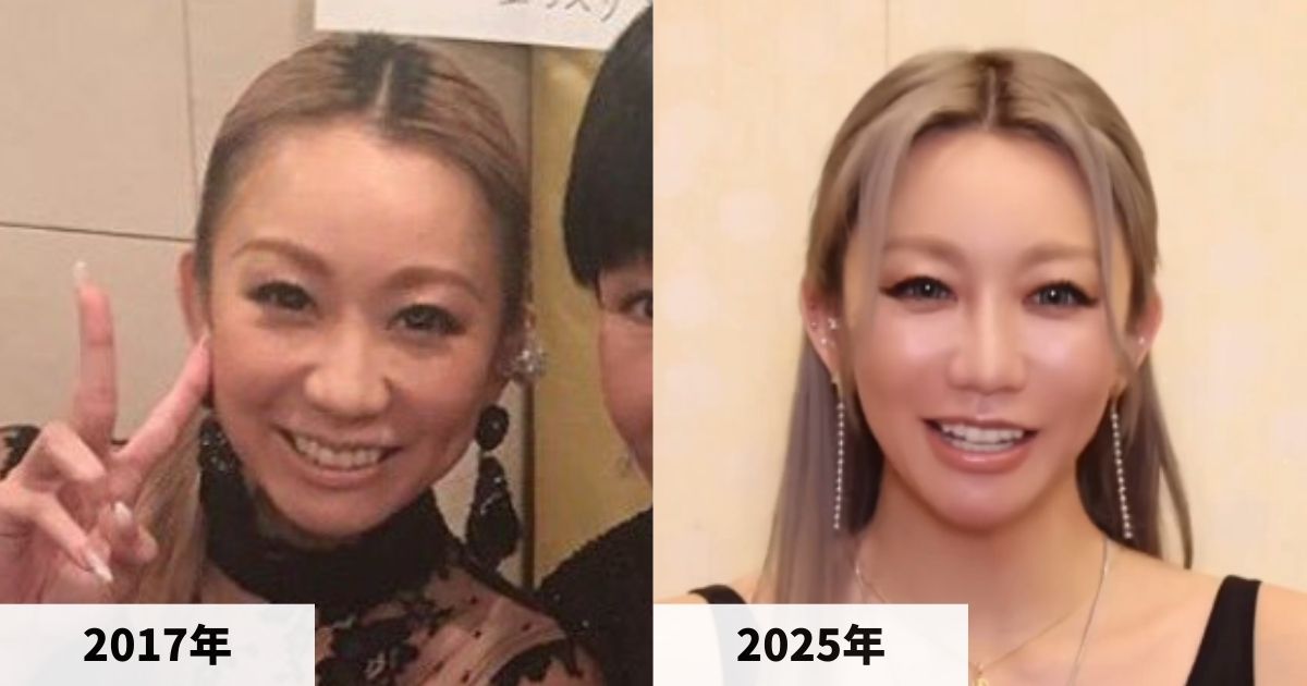 2017年と2025年の倖田來未さんの顔の比較画像