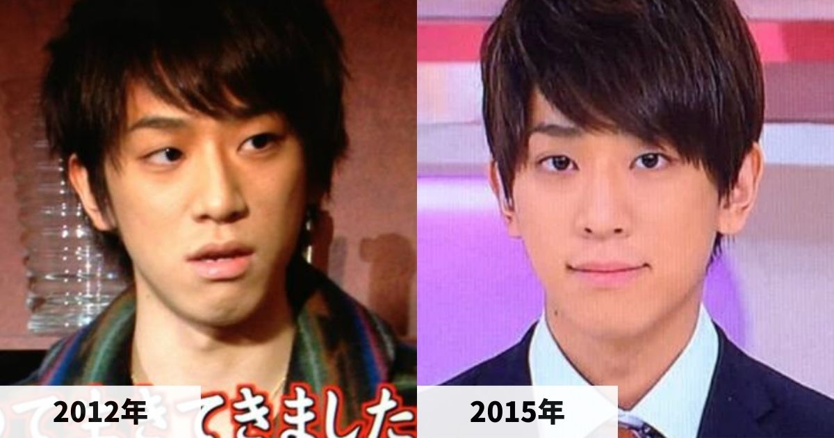 2012年と2015年の小山慶一郎さんの顔の比較画像