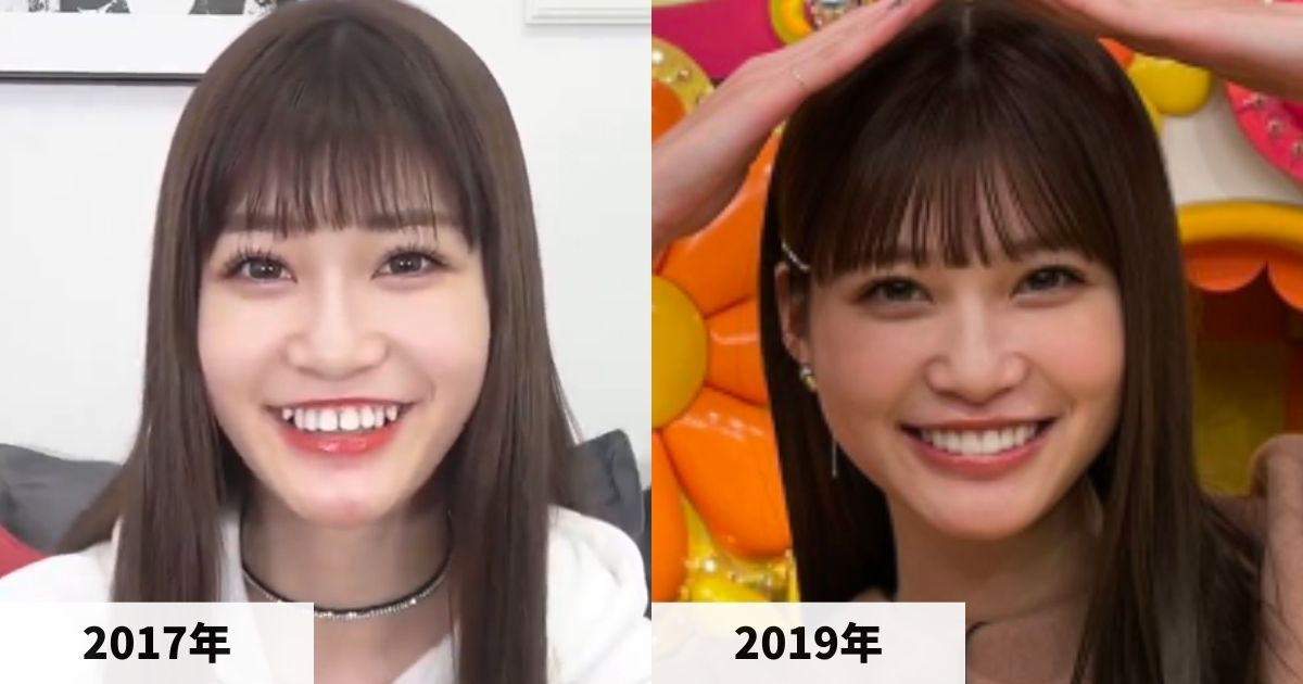 2017年と2019年のめるるさんの顔の比較画像