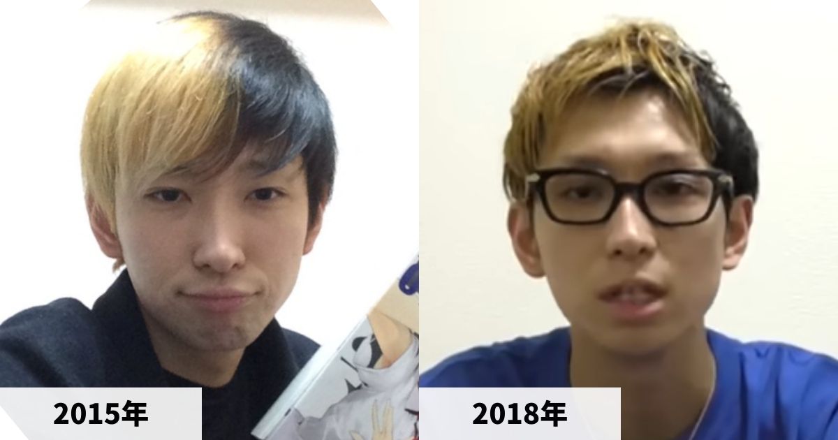 2015年と2018年のヒカルさんの顔の比較画像