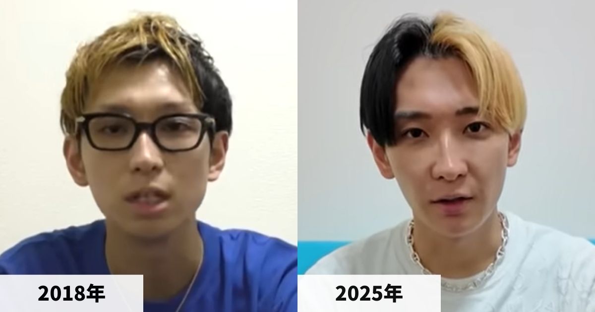 2018年と2025年のヒカルさんの顔の比較画像