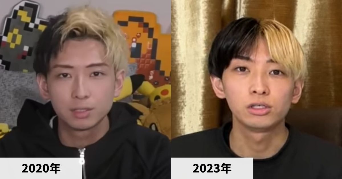 2020年と2023年のヒカルさんの顔の比較画像
