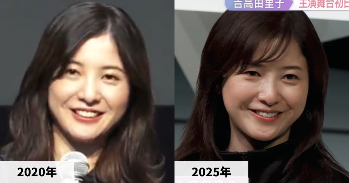 2020年と2025年の吉高由里子さんの顔の比較画像