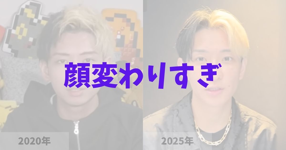 ヒカルの顔が変わりすぎてる理由は整形か？の記事