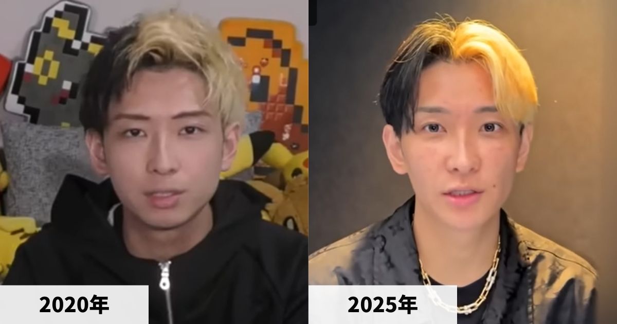 2020年と2025年のヒカルさんの顔の比較画像