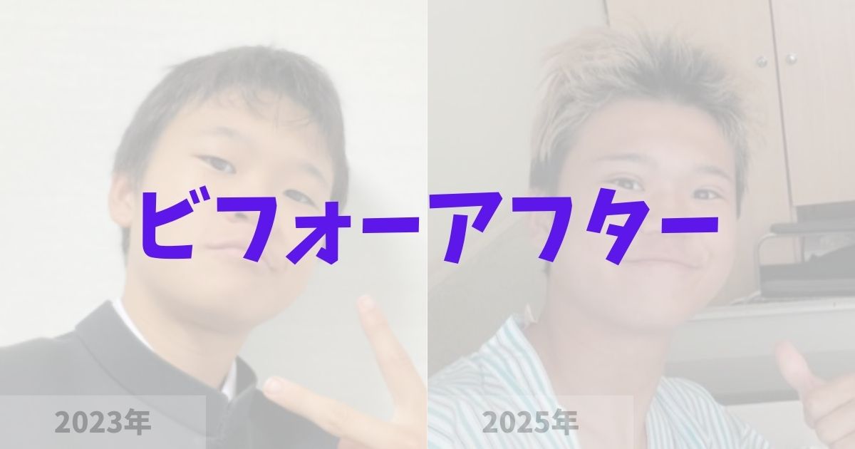 ゆたぼんの二重整形ビフォーアフター画像が衝撃！の記事