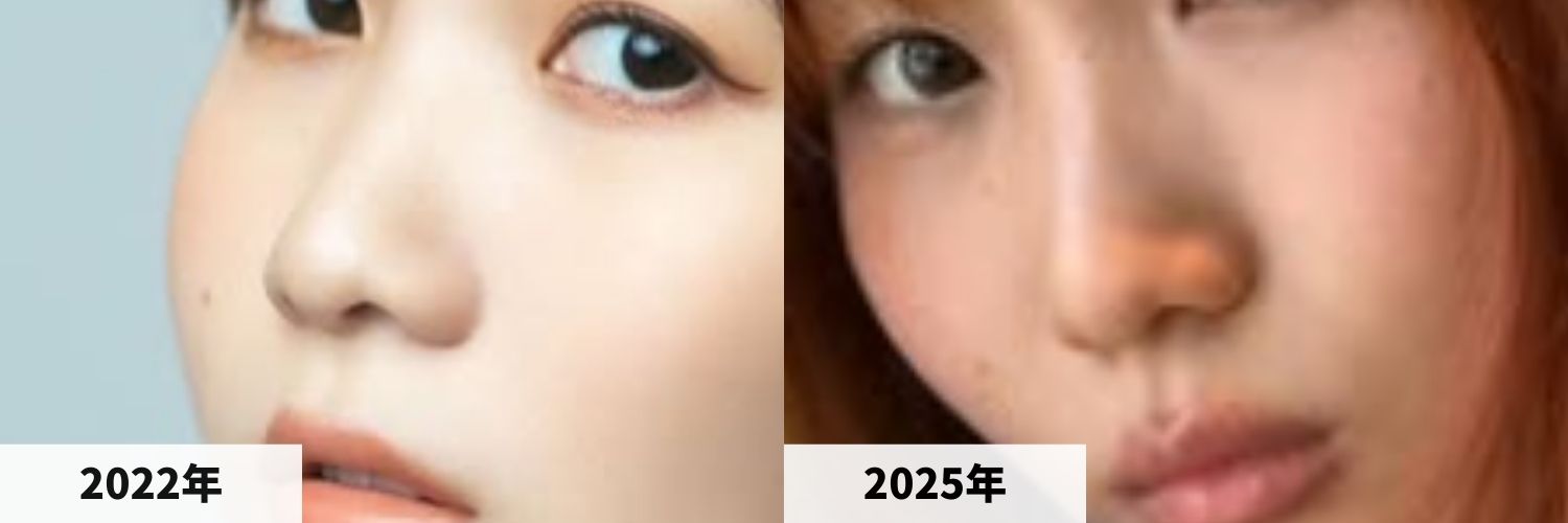 2022年と2025年の幾田りらさんの鼻の比較画像
