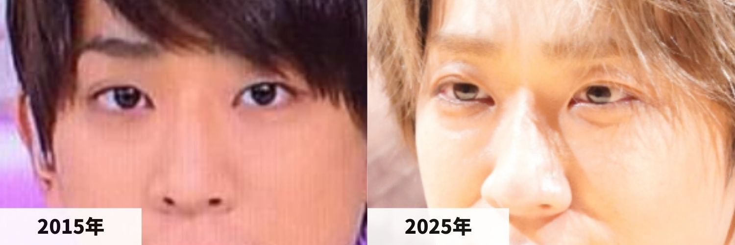 2015年と2025年の小山慶一郎さんの目と鼻の比較画像